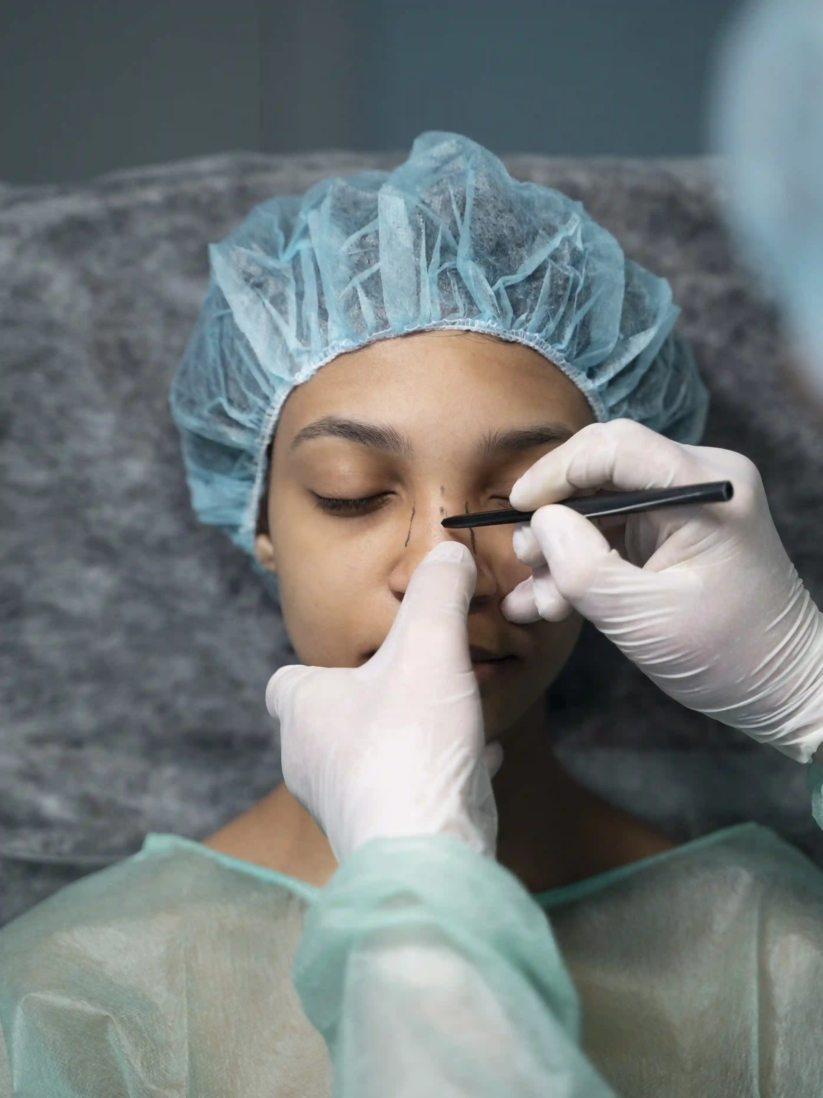 Nose surgery illustration